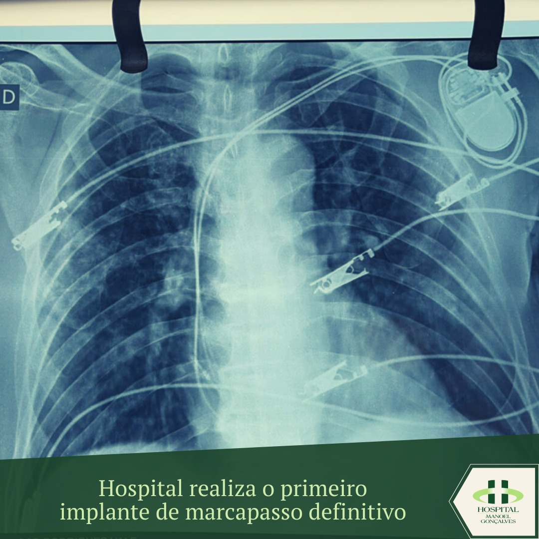 Hospital Manoel Gonçalves realiza primeiro implante de marcapasso