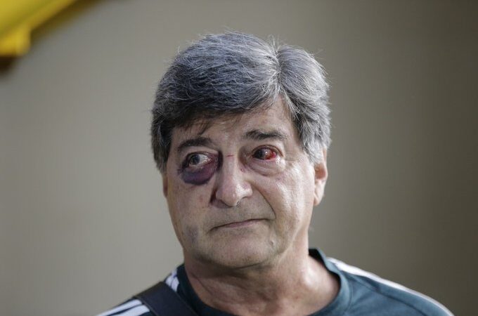 Vídeo: idoso é agredido e cai desacordado durante assalto em Copacabana