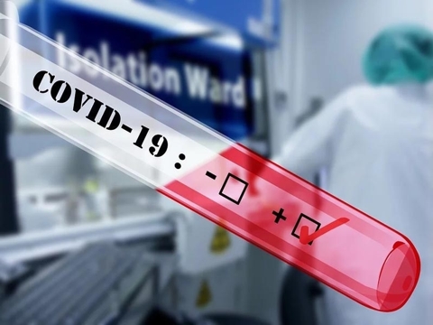 Governo de Minas restringe critérios para realização de exames RT-PCR da Covid-19