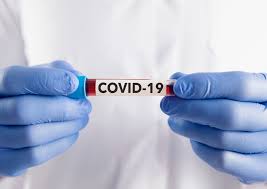 Quase 50 pessoas se infectam por dia em Itaúna com o vírus da Covid -19