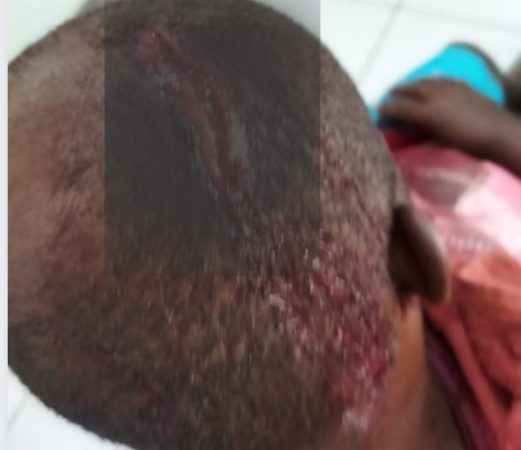 Homem reclama de som alto e é atacado com machadadas na cabeça