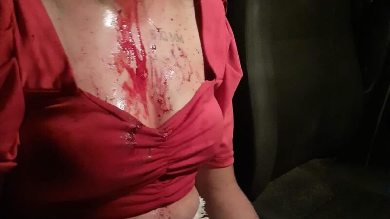 Jovem posta fotos e fala da agressão física que sofreu por parte do ex-marido