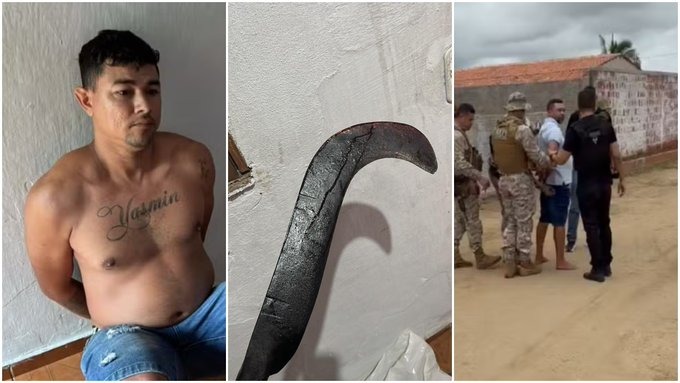 Vídeo: jovem tem as mãos reimplantadas após namorado amputá-las com foice, diz delegado