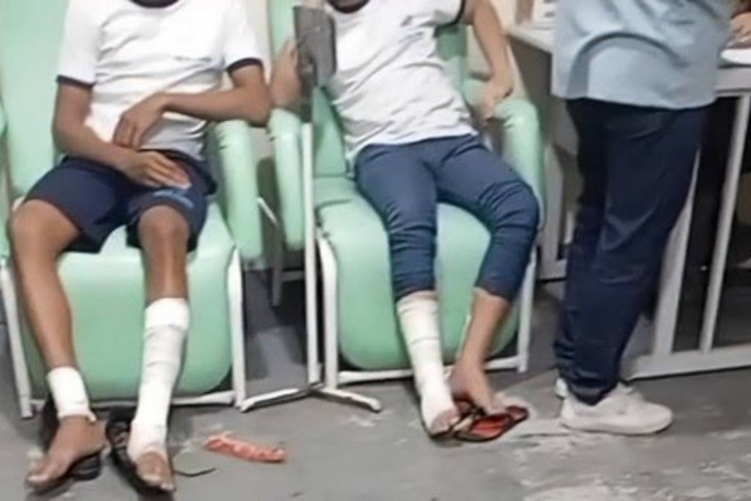 Vídeo: bomba caseira explode  em escola do Rio e pelo menos oito crianças ficam feridas